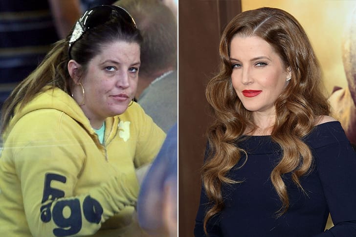 Lisa Marie Presley Before And After Plastic Surgery 36 Celebrity ...